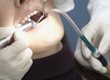Alsident System for dentists